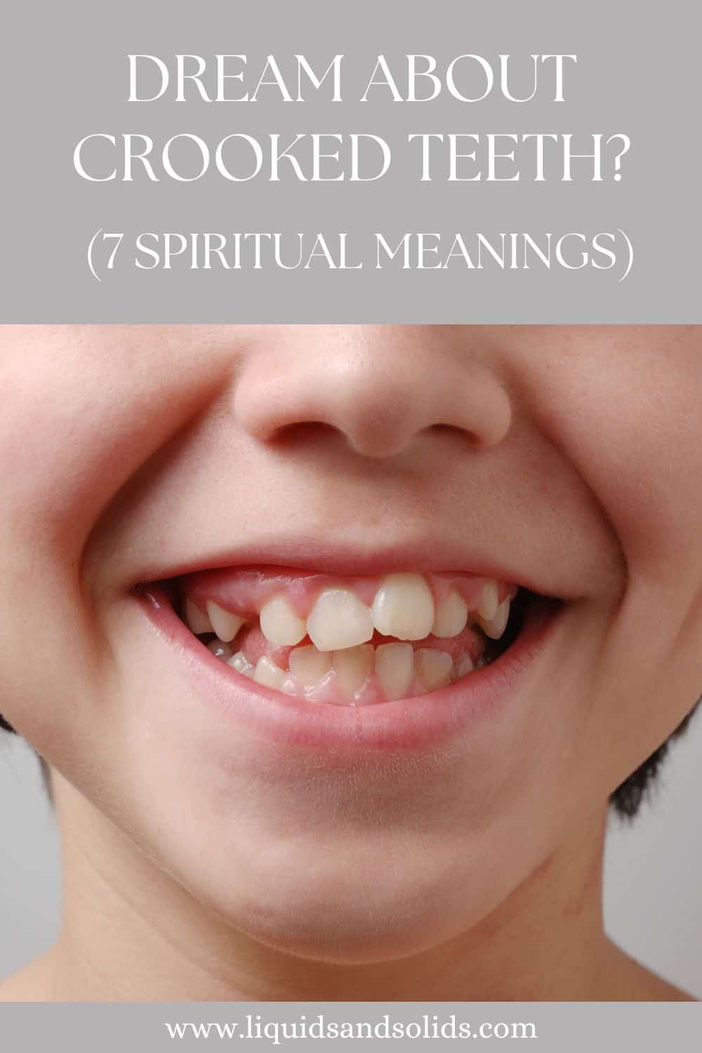Dream About Crooked Teeth? (7 Spiritual Meanings)
