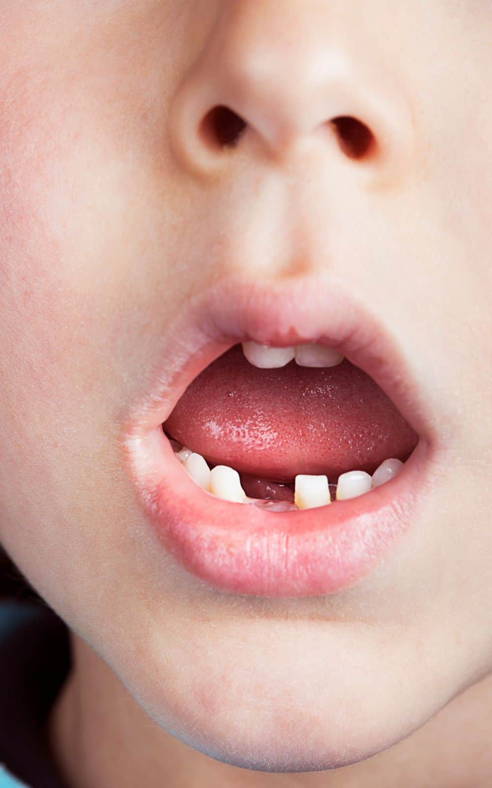 Teeth Crumbling Dream - What do our teeth mean to us